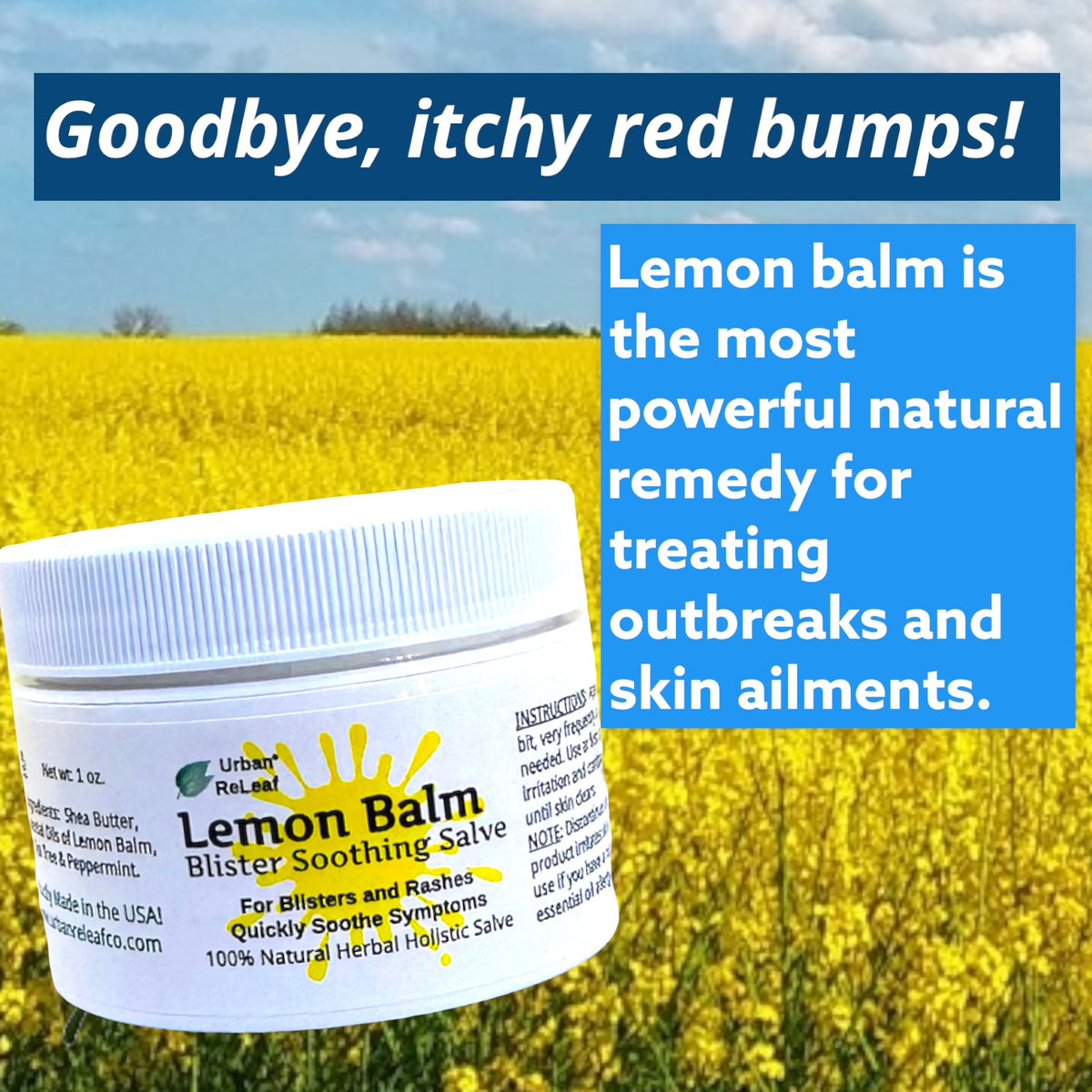 Cold Sore Shingles Blister Treatment Urban ReLeaf Lemon Balm Blister ...